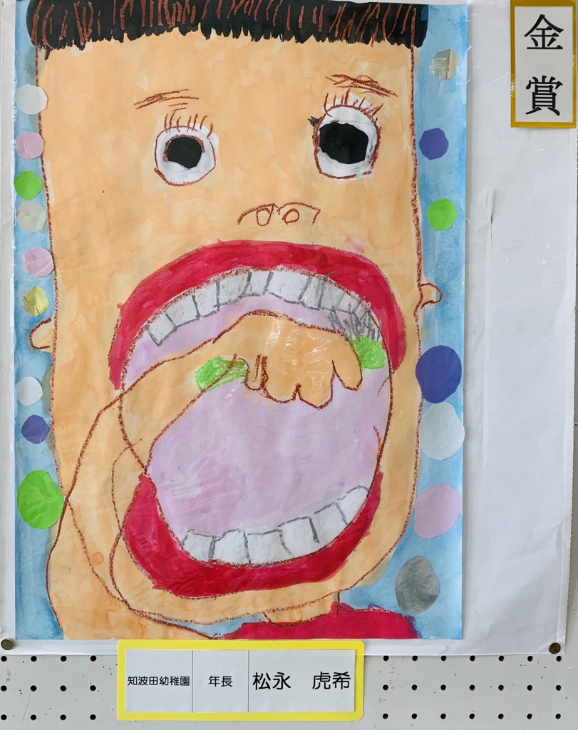 幼稚園の部金賞のポスターの写真