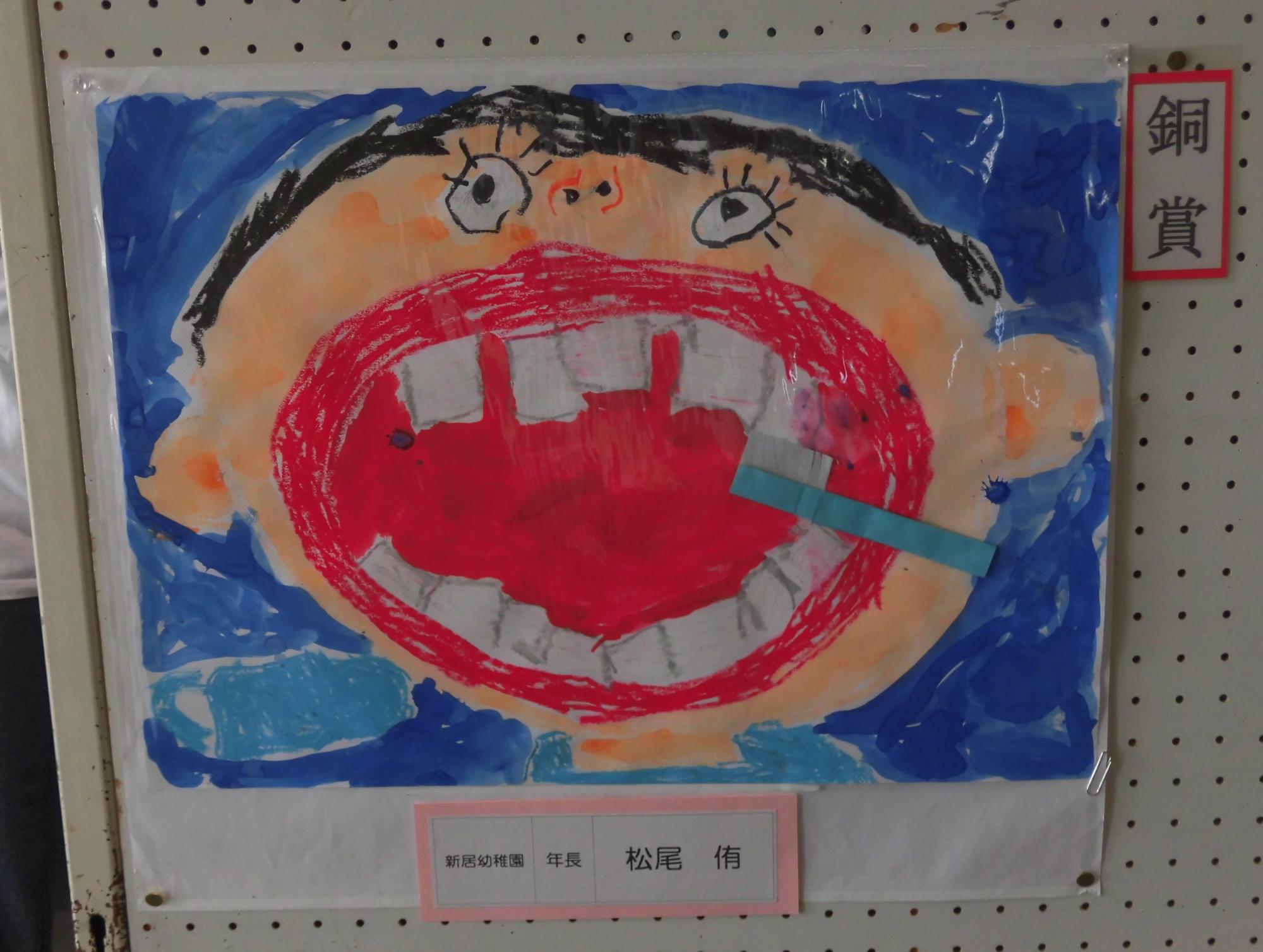 幼稚園の部銅賞のポスターの写真