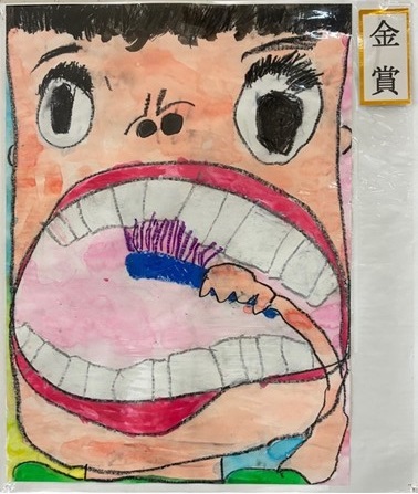幼稚園の部金賞のポスターの写真